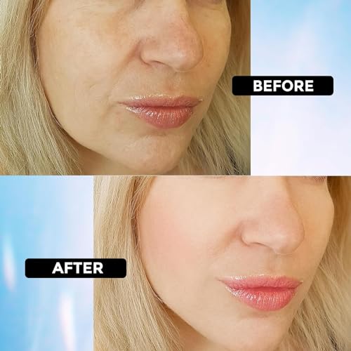 +1HEROLABS Hyaluronic Acid Serum for Face Anti Aging, Fine Lines, Dark Spots, & Dry Skin - Hydrating Facial Serum - Best Face Serum for Moisturizing and Wrinkle Reducing, 2 Packs