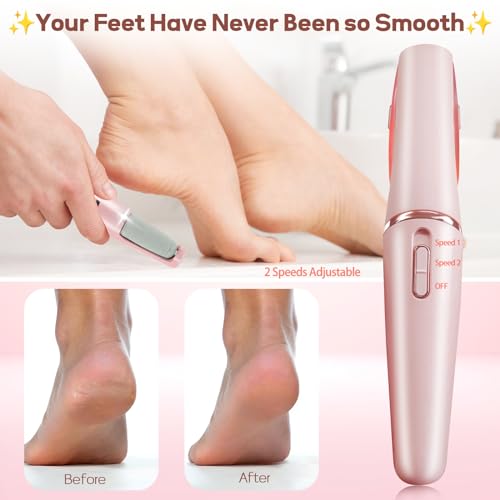 Smooth Pedicure Wand, Electric Foot Callus Remover Rechargeable Pedicure Tool Callus Remover for Feet Electronic Foot File, Feet Care for Removes Dry Hard & Dead Skin Ideal Gift (Pink)