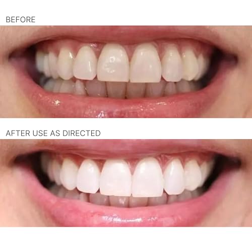 Nu Skin AP 24 Whitening Fluoride Toothpaste | 4oz | Brightens and Whitens Teeth | Helps Prevent Dental Cavities | Gentle Vanilla Mint Formula (1 Pack, Flouride)