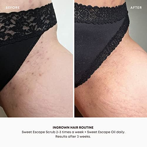 Bushbalm Dark Spots and Ingrown Hair 2 Step Routine - Rejuvenate and Nourish - Ingrown Hair Oil (30 ml) and Exfoliating Scrub (236 ml) - Bermuda
