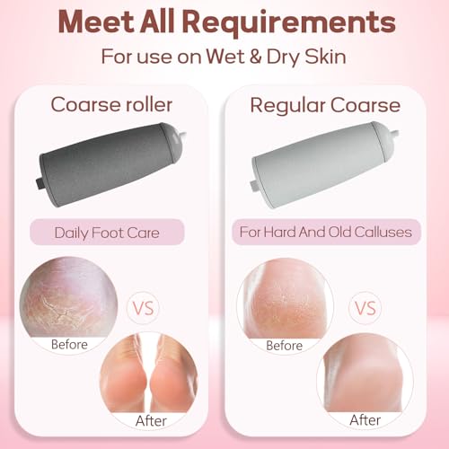 Smooth Pedicure Wand, Electric Foot Callus Remover Rechargeable Pedicure Tool Callus Remover for Feet Electronic Foot File, Feet Care for Removes Dry Hard & Dead Skin Ideal Gift (Pink)