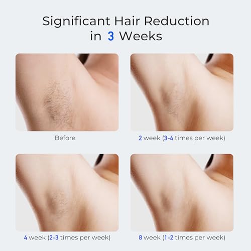 LUBEX Smart Permanent IPL Laser Hair Removal for Woman and Men, Painless Sapphire Ice-Cooling, Alternative to Salon, Bikini Shaver, Facial Epilator for Armpits Back Legs Arms Face Bikini Glow 6 A+