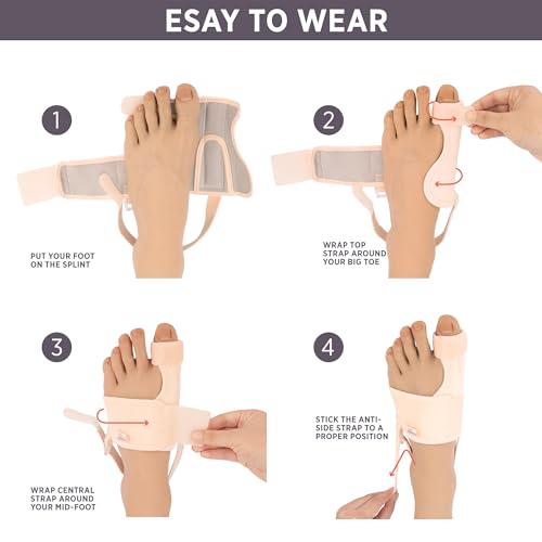 PEDIGOO Bunion Corrector for Women 2pc, Non-Slip Bunion Toe Separator, Hallux Valgus Relief for Day/Night Support (Beige)