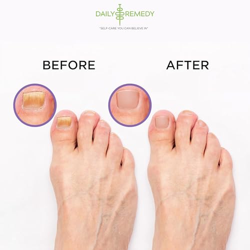 Calming Lavender Foot Soak with Epsom Salt, Made in USA, Foot Soak Soothes Sore Tired Feet, Athletes Foot, Stubborn Foot Odor, Softens Calluses & Helps Treat Toenail, 16 oz 1 lb
