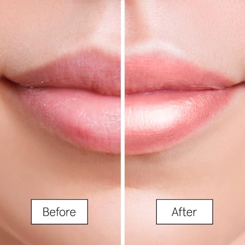 Grace & Stella Award Winning Lip Plumper Nourishing Berry Lip Mask - Lip Balm Hydrating - Lip Moisturizer For Very Dry Lips - Overnight Lip Mask & Lip Treatment & Lip Sleeping Mask - Vegan