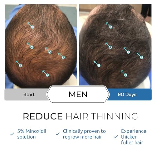 Spectral.UHP 5% Minoxidil Hair Growth Serum for Men by DS Laboratories - Extra Strength Topical Hair Loss Treatment, Supports Hair Growth in the Vertex, Experience Fuller, Thicker Hair (2 fl oz)