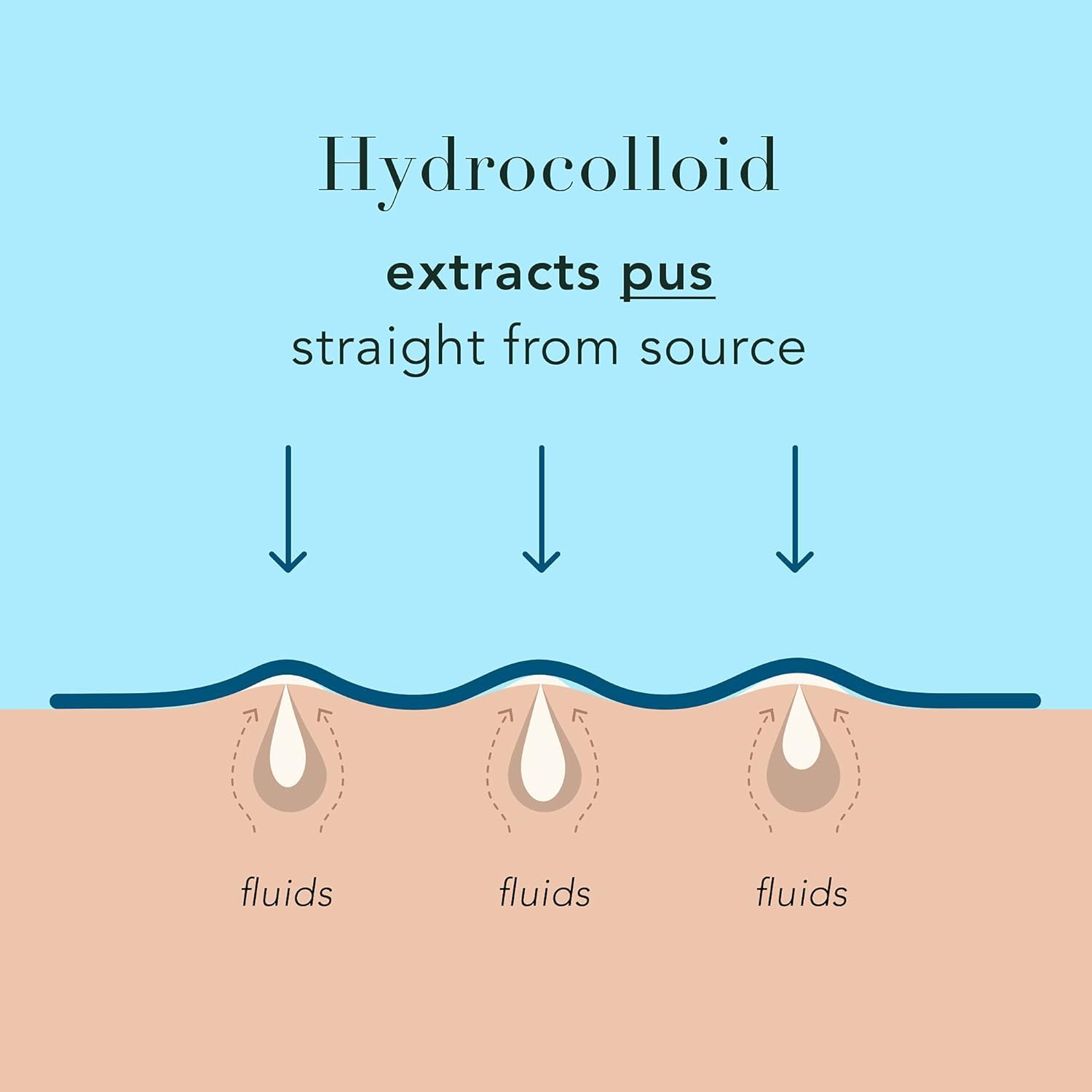 Rael Pimple Patches, Miracle XL Spot Control Cover - Hydrocolloid Acne Patches for Face, Zit and Blemish Spot, Back and Body, for All Skin Types, Vegan, Cruelty Free (6 Count)