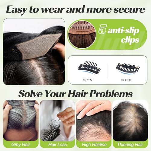 starluck 16 inch Hair Toppers for Women 9"*9" Large Base Honey Brown Real Human Hair Topper No Bangs Hair Toppers for Women with Thinning Hair Cover Grey Hair Roots Add Volume