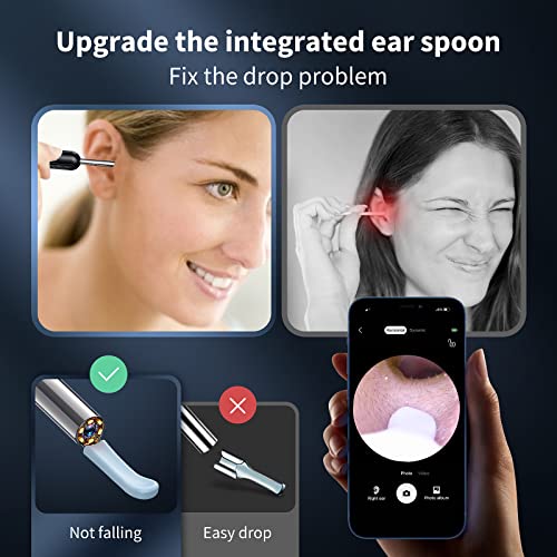 Ear Wax Removal Tool, Earwax Removal Kit with 8 Pcs Ear Set, Ear Cleaning Kit with 6 Ear Pick, Ear Cleaner Otoscope with Light, Ear Camera for iPhone, iPad, Android Phones (Black)