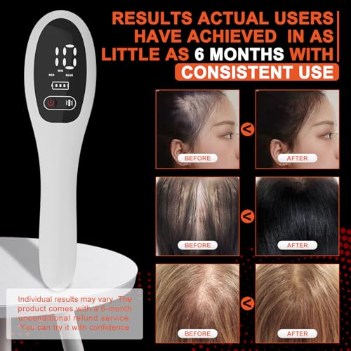 PUPCA Laser Comb (FDA Cleared) - Professional Medical Grade Red Light Treatment with Lasers for Hair Growth, Electric Scalp Massager for Alopecia in Men & Women