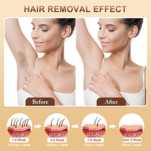Aopvui Laser Hair Removal Device for Women and Men, 3-in-1 Upgraded 999,900+ Flashes at-Home IPL Hair Removal Device, Laser Hair Removal with 2 Mode 9 Energy Levels