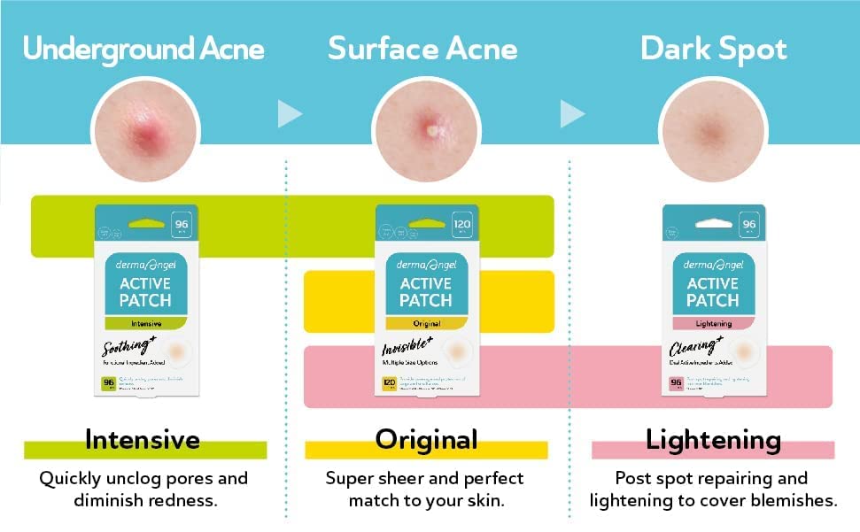 DERMA ANGEL Ultra Invisible Acne Patches Salicylic Acid Acne Patches for Cystic Acne Blemish Patches Hydrocolloid Patches Zit Patches - Day and Night Use - UPGRADED (Acne Specialist-132 Count-2 Sizes)
