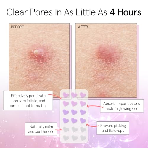 grace & stella Award Winning Pimple Patches For Face (Heart, 36 Count) - Hydrocolloid Acne Patches for Face - Dermatologist Tested, Vegan, Cruelty-Free Zit Patches for Face, Blemish Patches