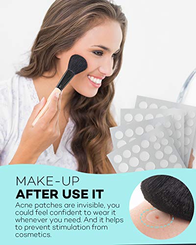 Acne Patch Pimple Patch, 4 Sizes 140 Patches Acne Absorbing Cover Patch, Hydrocolloid Invisible Acne Patches For Face Zit Patch Acne Dots Tea Tree, Calendula Oil
