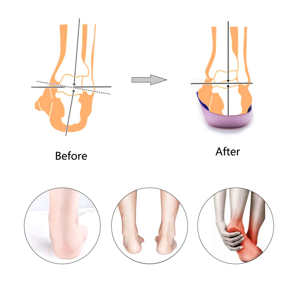 PCSsole’s 3/4 Orthotics Shoe Insoles High Arch Supports Shoe Insoles for Plantar Fasciitis, Flat Feet, Over-Pronation, Relief Heel Spur Pain