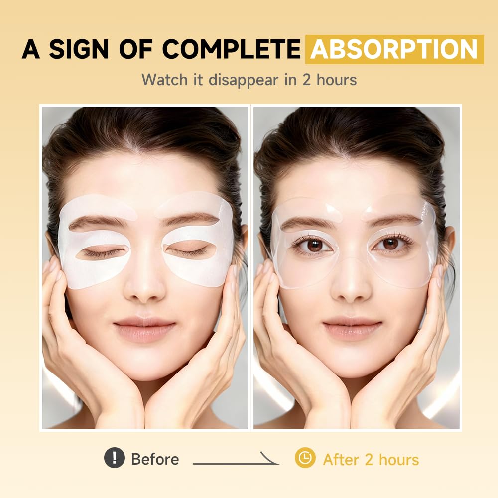 8 Pairs 5% PDRN Under Eye Patches, 6-in-1 Bio-Collagen 360° Eye Patches for puffy eyes, dark circles & Wrinkle | 2% Caffeine, Kojic acid, Retinol, Hyaluronic, Niacinamide | Korean Eye Care