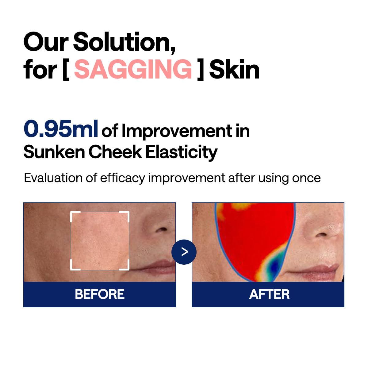 MEDIHEAL Collagen Ampoule Facial Toner Pads - Collagen & Ceramide - Skin Firming & Restore Elasticity & Deep Hydration - Tighten Wrinkles & Lines - Vegan Eco Silk Fabric, 100 Pads