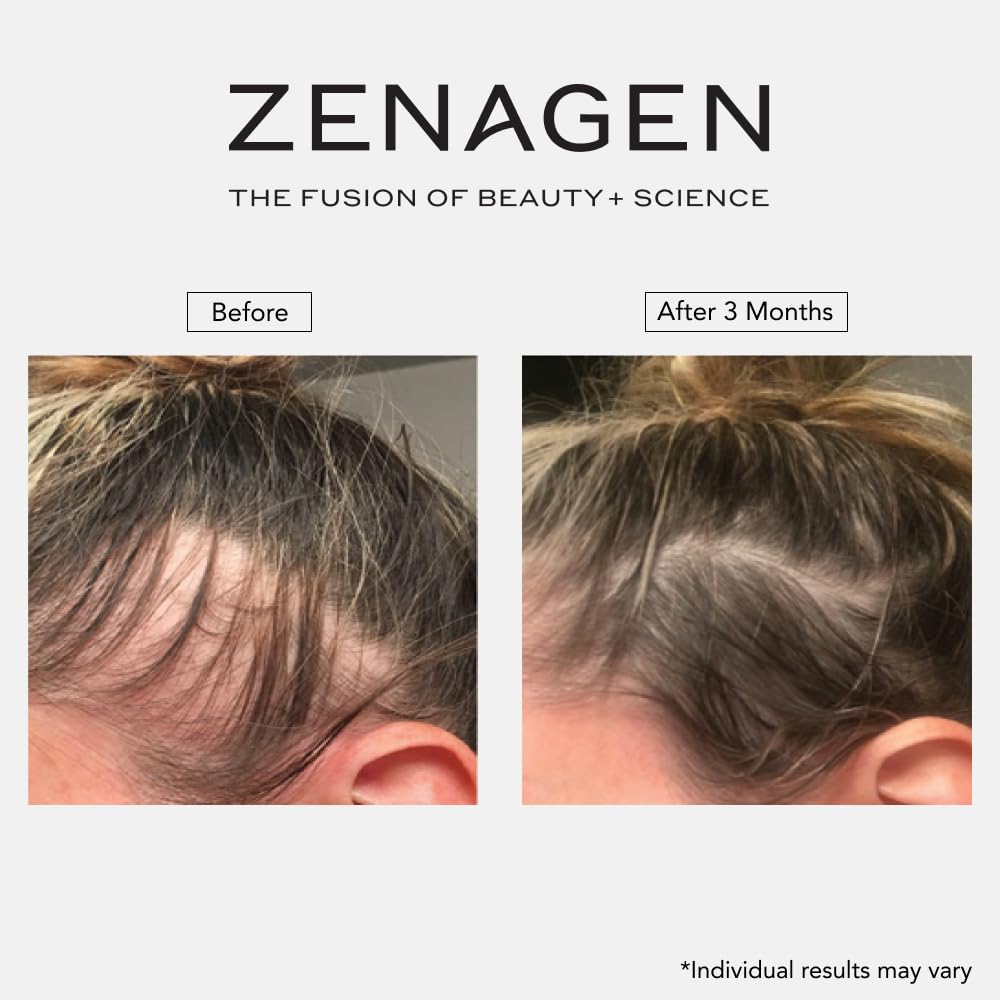 ZENAGEN Revolve Women's Thickening Shampoo | Supports Appearance of Fuller, Healthier-Looking Hair, Developed for Fine & Visibly Thinning Hair, Plant-Based, 5-Minute Treatment, 200 mL / 6.75 oz