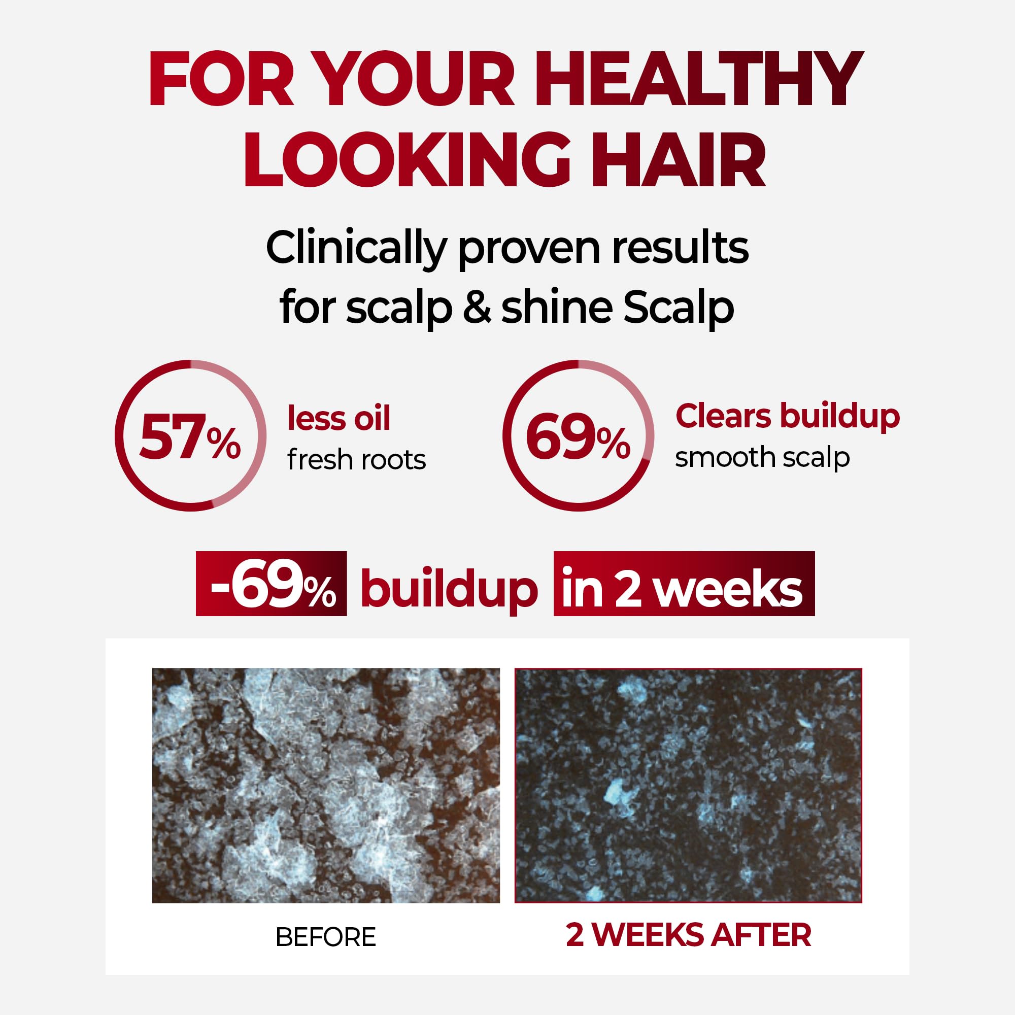 KUNDAL Caffeine hair Korean Hair Care Shampoo, White Musk, 16.9 Fl Oz - Sulfate Free, Menthol & Botanical Extracts, For Fuller Looking Hair, Refresh & Manageability