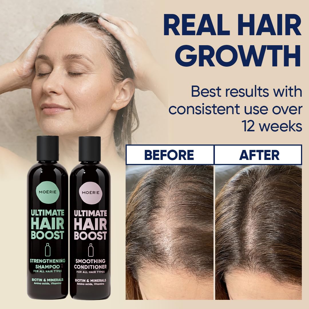 Moerie Hair Growth Shampoo and Conditioner for Women and Men, Hair Loss Solution with Biotin and Rosemary, Thickening Shampoo and Conditioner for Thinning Hair – Promotes Regrowth