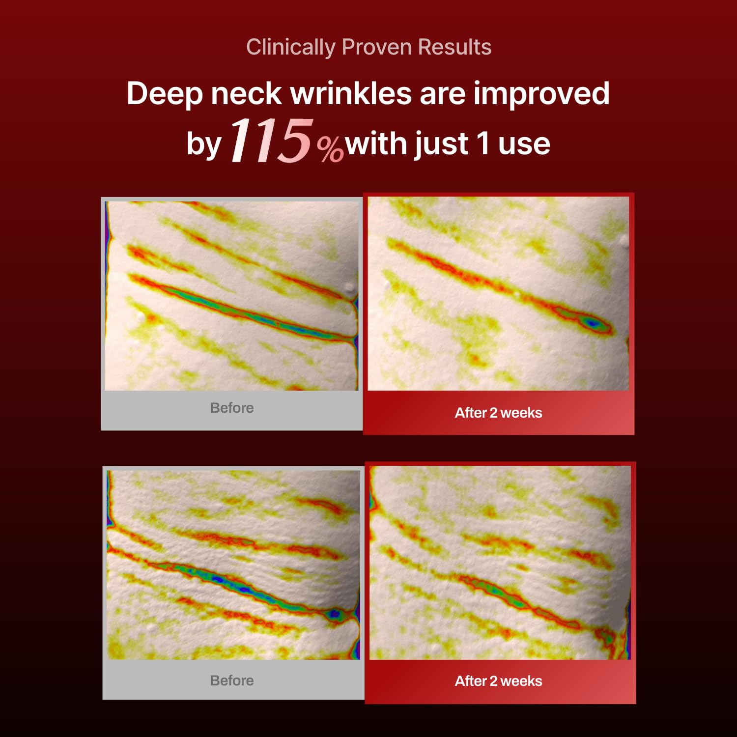 Wrinkle-fit Neck Mask - Neck Wrinkle Patches, Firming and Tightening Korean Deep Collagen Mask - Hyaluronic Acid NeckTargeted Mesh Sheet Mask for Lifting Sagging Skin - Boosting Elasticity 7EA