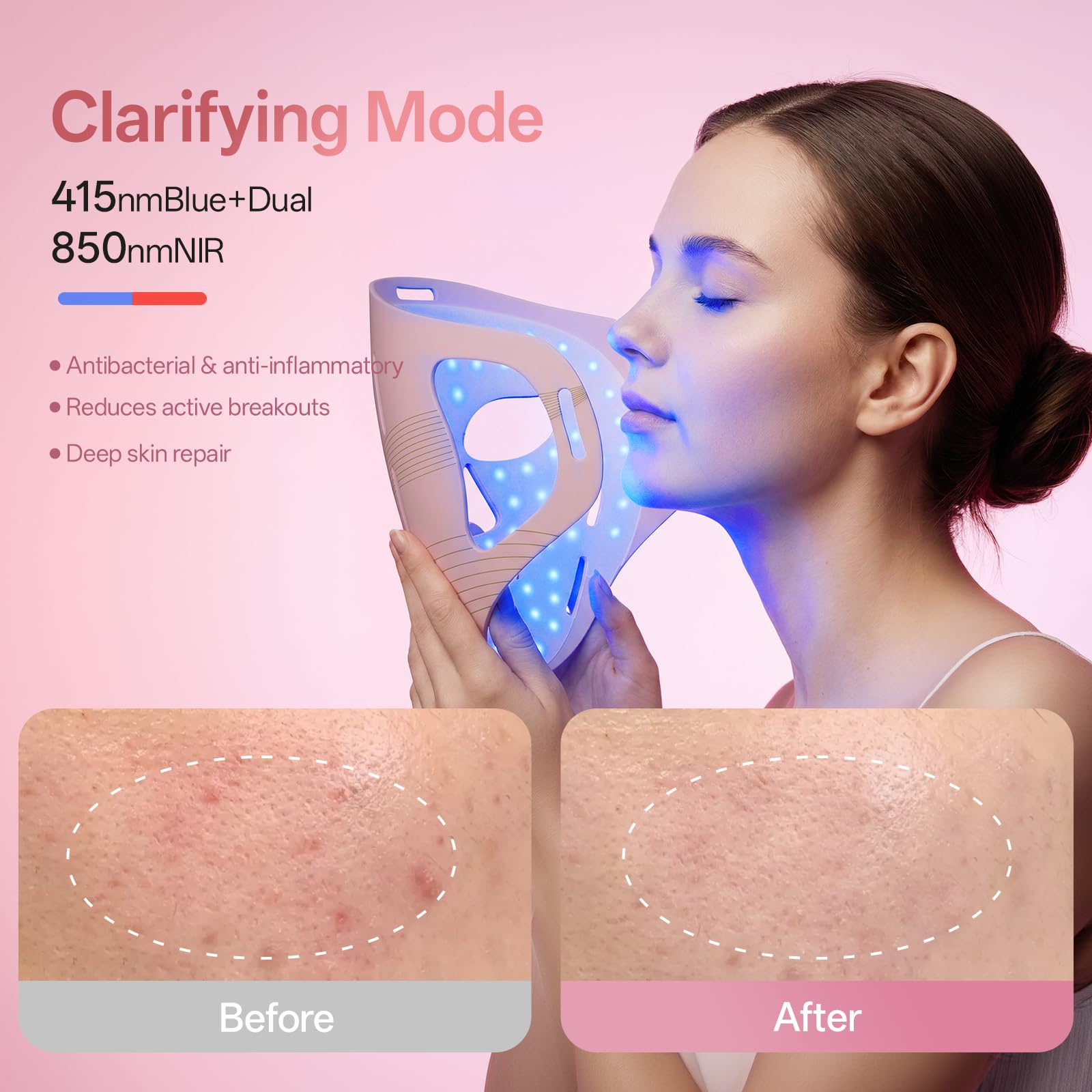 Red Light Therapy for Face & Jawline-FDA Cleared 4D Face Mask with 324 LEDs,6 Modes (Red/Blue/Infrared) |Cordless for Home & Travel | Skincare Gifts for Women- Anti Aging LED Mask-Firm,Glowing Skin