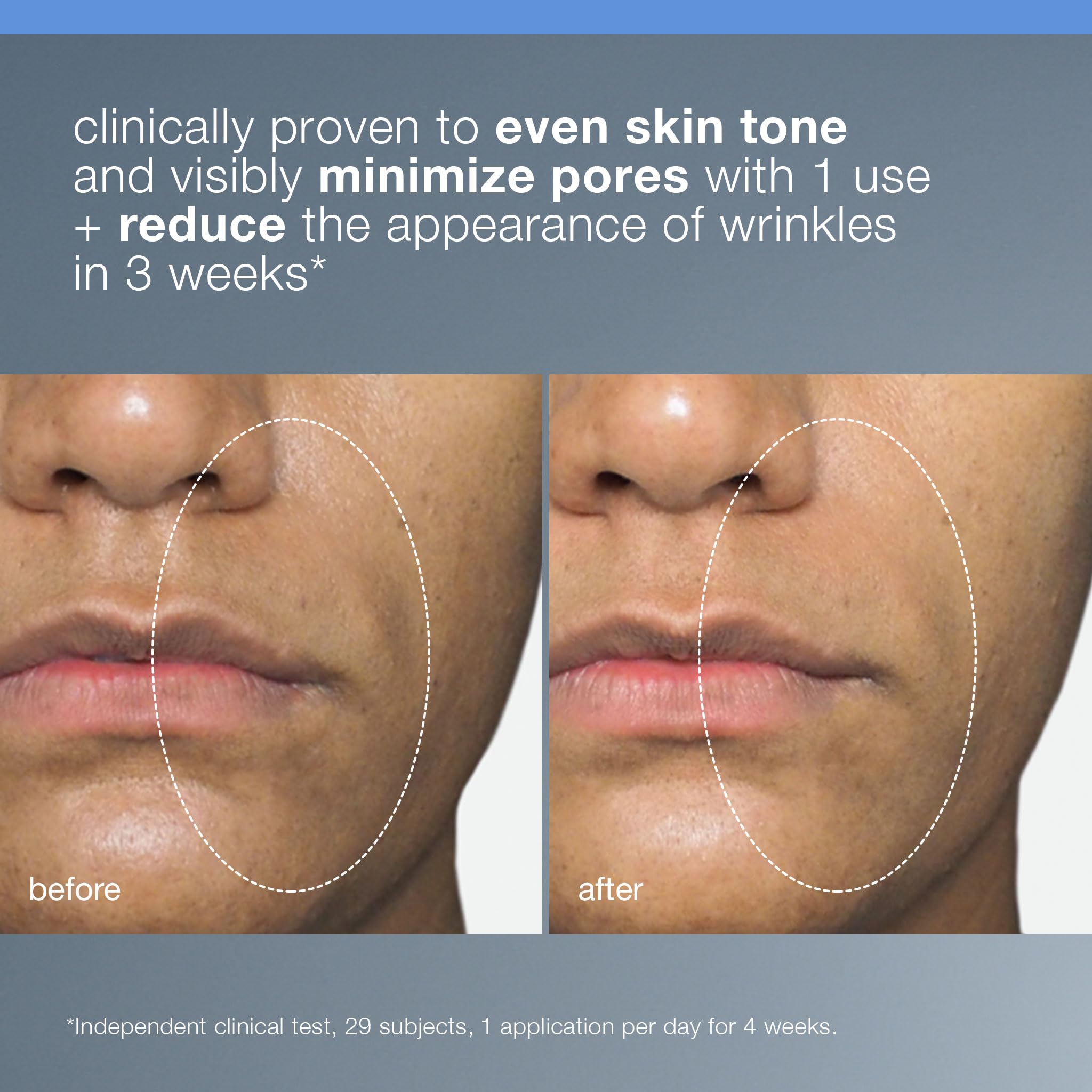 Dermalogica Liquid Peelfoliant with Glycolic Acid, Face Exfoliator Peel with AHA BHA PHA, Smooths Fine Lines and Wrinkles, Unclogs Pores, and Improve Skin Tone - 2 fl oz