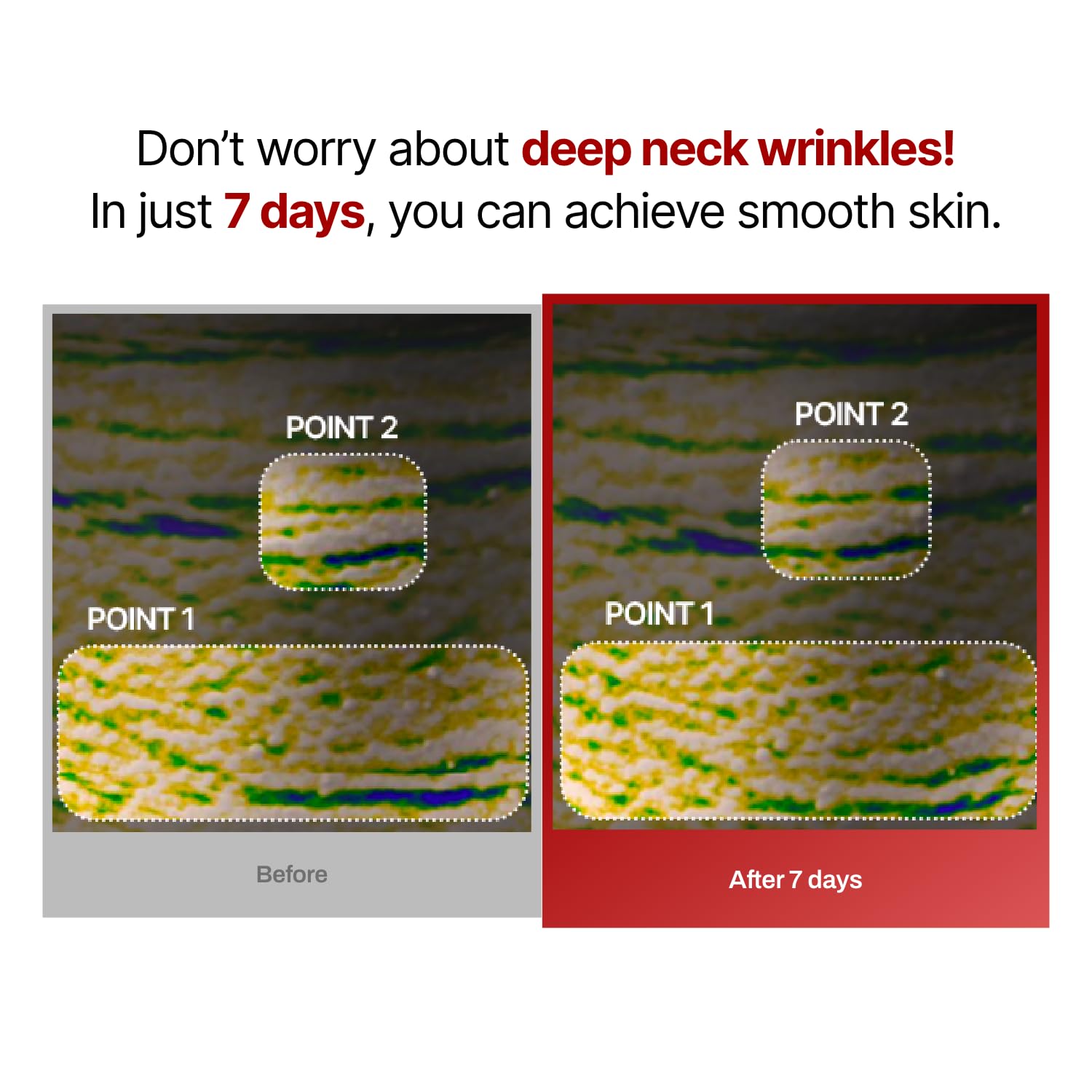 Wrinkle-fit Neck Mask - Neck Wrinkle Patches, Firming and Tightening Korean Deep Collagen Mask - Hyaluronic Acid NeckTargeted Mesh Sheet Mask for Lifting Sagging Skin - Boosting Elasticity 7EA