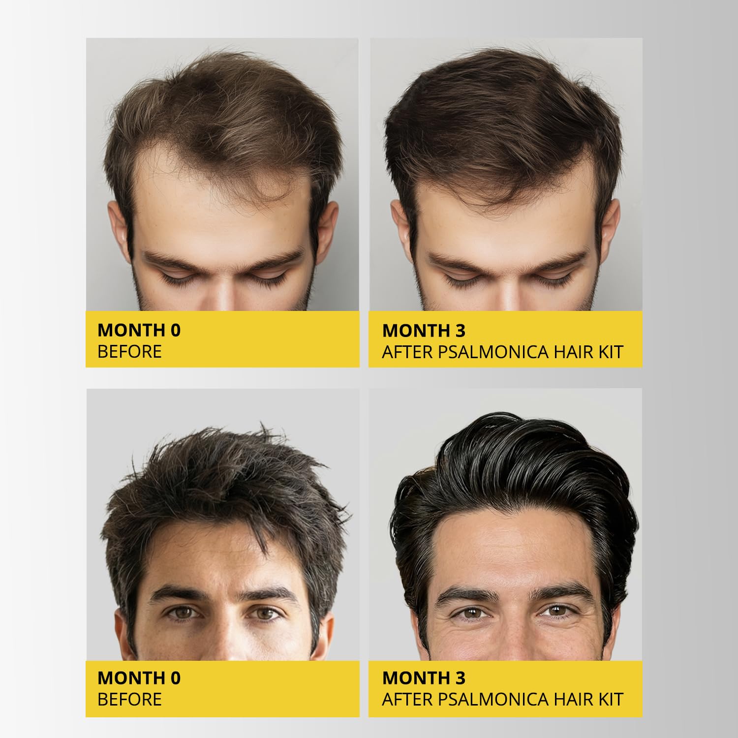 Hair Growth Shampoo and Conditioner Set: Sulfate Free Hair Growth Root Activator Thickening Shampoo for Hair Loss and Thinning Hair - Hair Loss RegrowthTreatments for Women Men