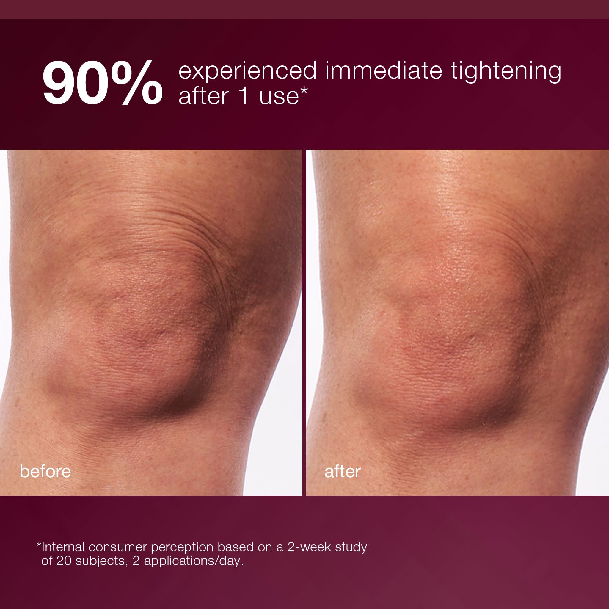 Dermalogica Dynamic Skin Sculptor Body Serum, Firimg and Hydrating Body Sculping Lotion - Tightens, Tones, and Sculpts Skin, 5.1 fl oz