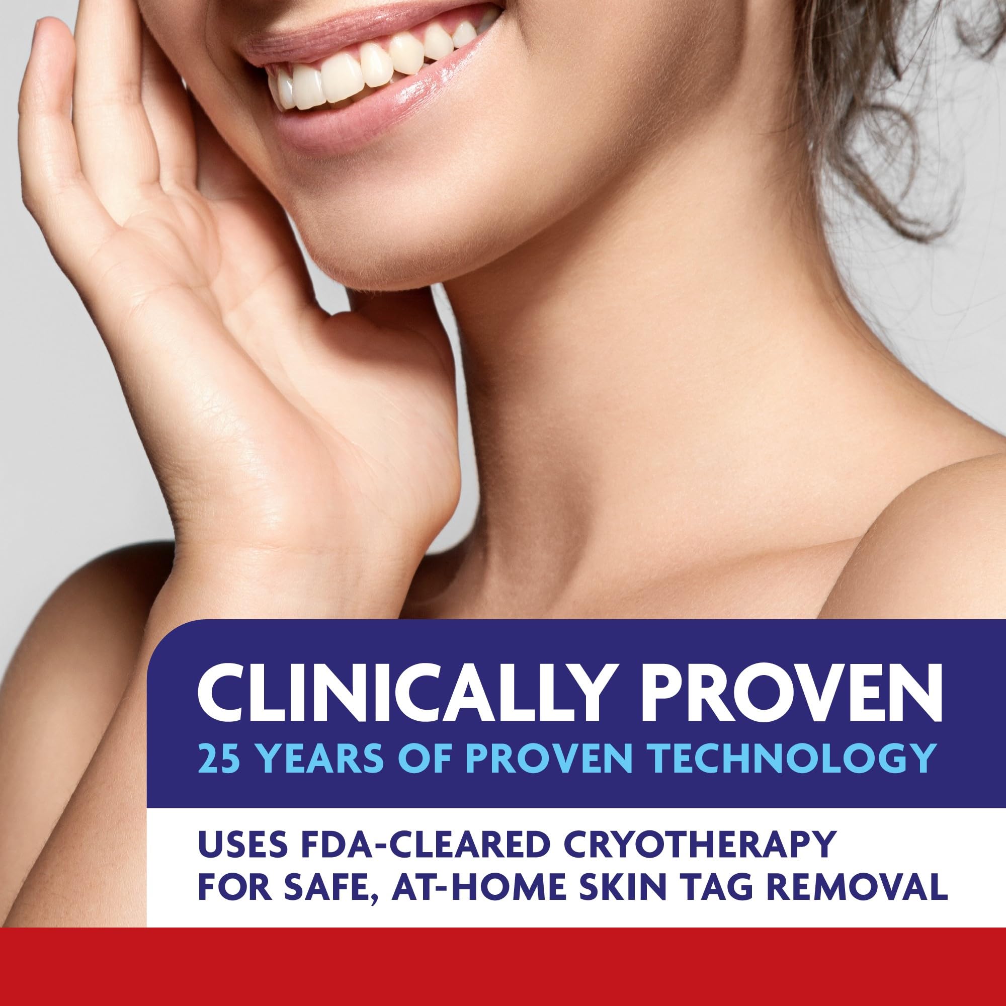 ALOCANE Precision Freeze, Skin Tag Remover, FDA-Cleared at-Home Cryotherapy Skin Tag Removal Kit with 12 Precision Tip Applicators, Helps Remove Skin Tags in As Little As 1 Treatment