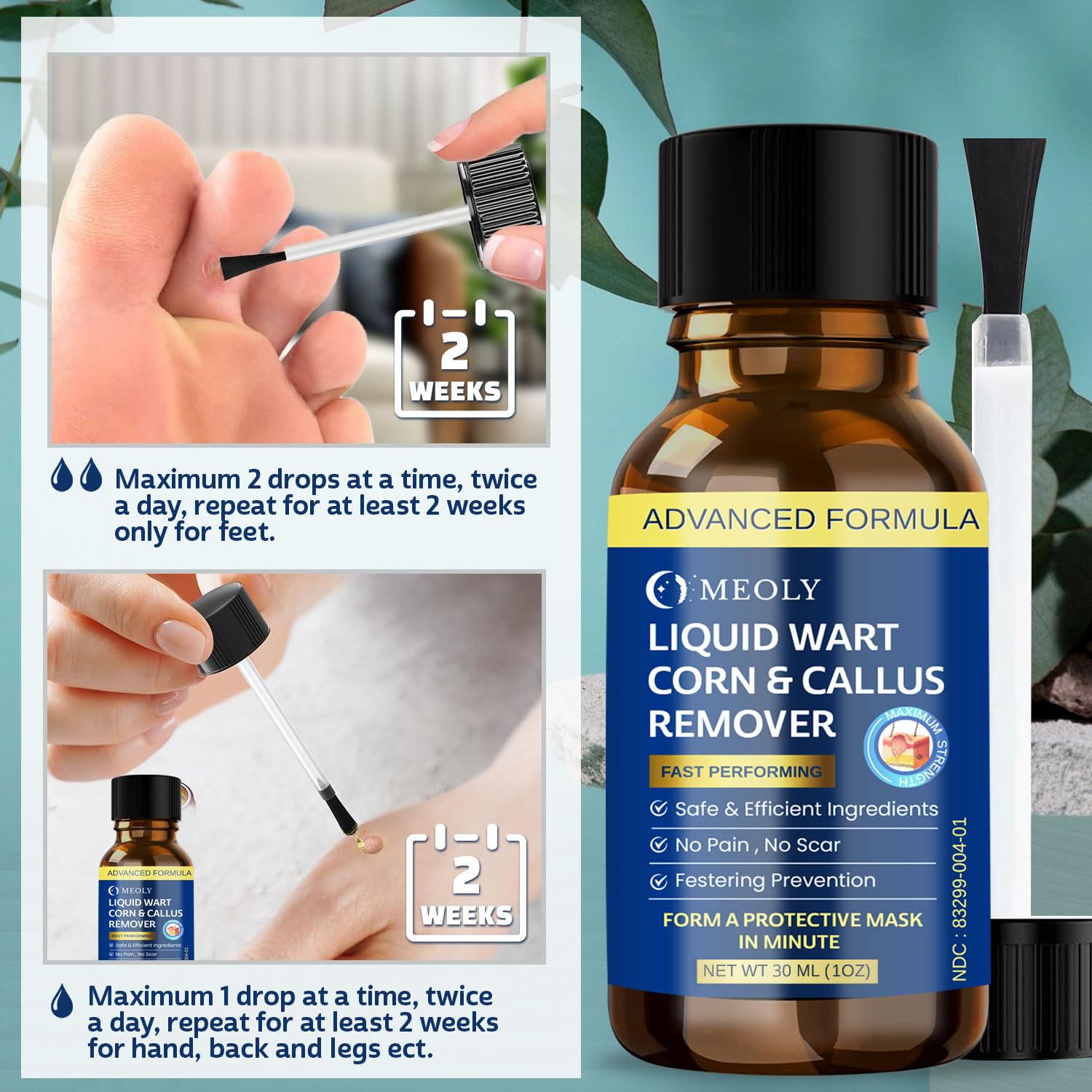 MEOLY Fast-Acting Wart Remover Freeze Off : Salicylic Acid Wart Remover for Men Women - Wart Removal for Plantar Wart, Genital Wart, H Warts, Common Wart, Flat Wart, Corn, Callus 30 ML