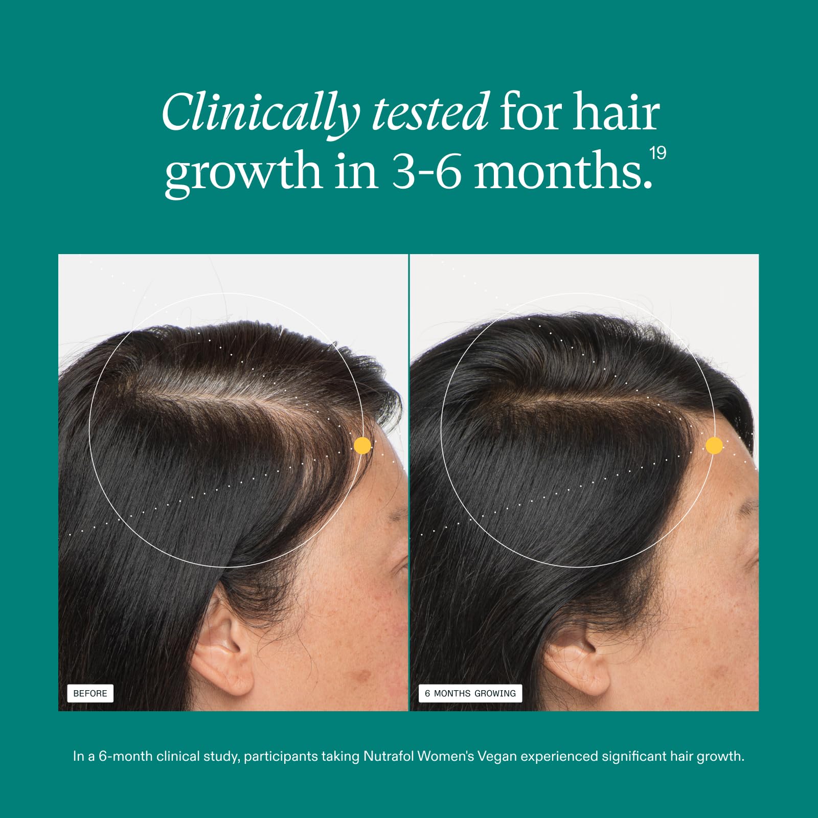 Nutrafol Women's Hair Growth Supplements, For Women 18-44 Years Old, Clinically Tested for Visibly Thicker, Stronger Hair, 100% Vegan Ingredients, Dermatologist Recommended - 2 Month Supply, 2 Pouches