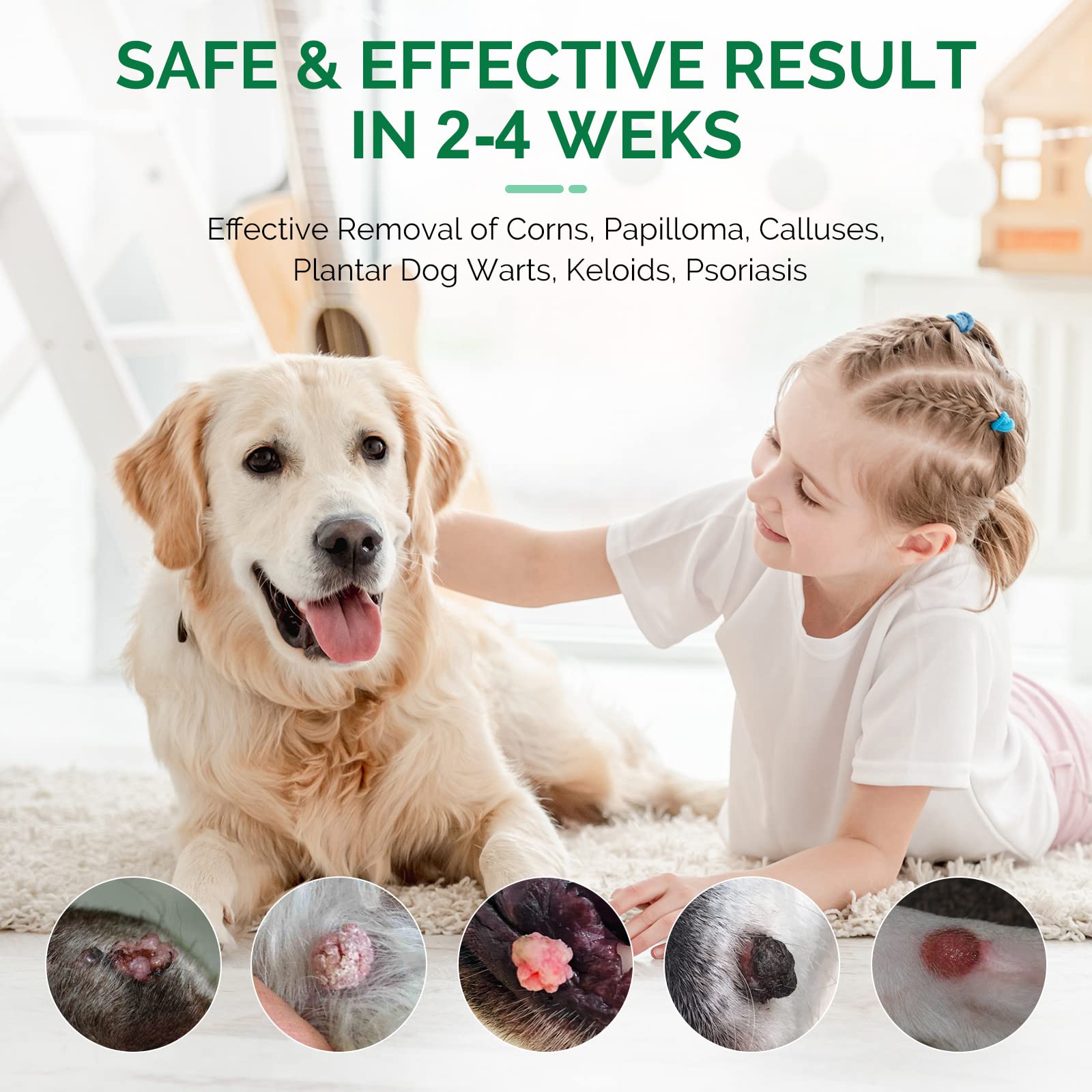 rubvil Dog Wart Remover, Natural Dog Skin Tag Remover, Gentle & Safe for Pet, Effective Dog Skin Treatment at Home