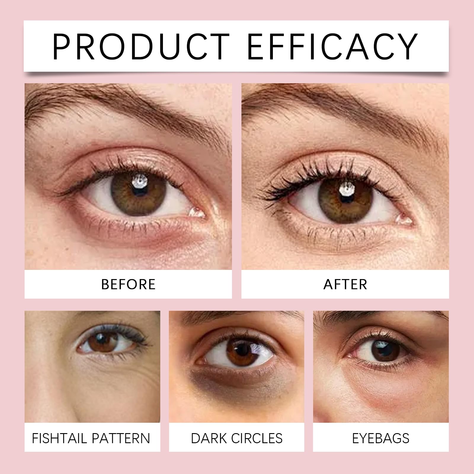 NOVALIFT Eye Patches, 2 Bag(6 Patches) Hyaluronic Acid & Collagen Under Eye Mask for Dark Circles, Puffiness & Fine Lines, Deep Hydrating Anti-Wrinkle Eye Pads + Forehead