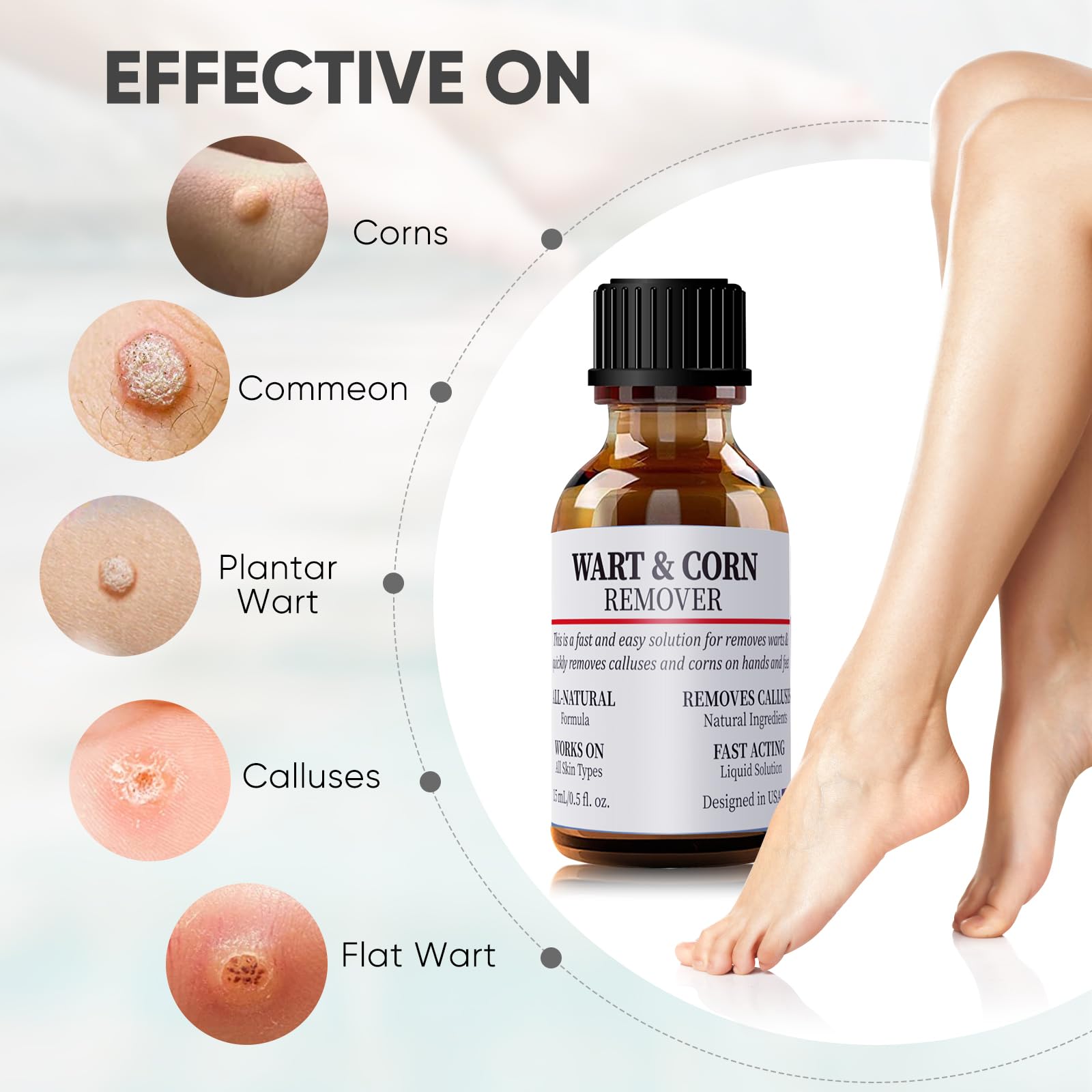 WABRINY Wart & Corn Remover Liquid, Smoothes Skin Gentle Fast Acting Gel Wart Removal for Plantar Wart Flat Warts and Corns-G3