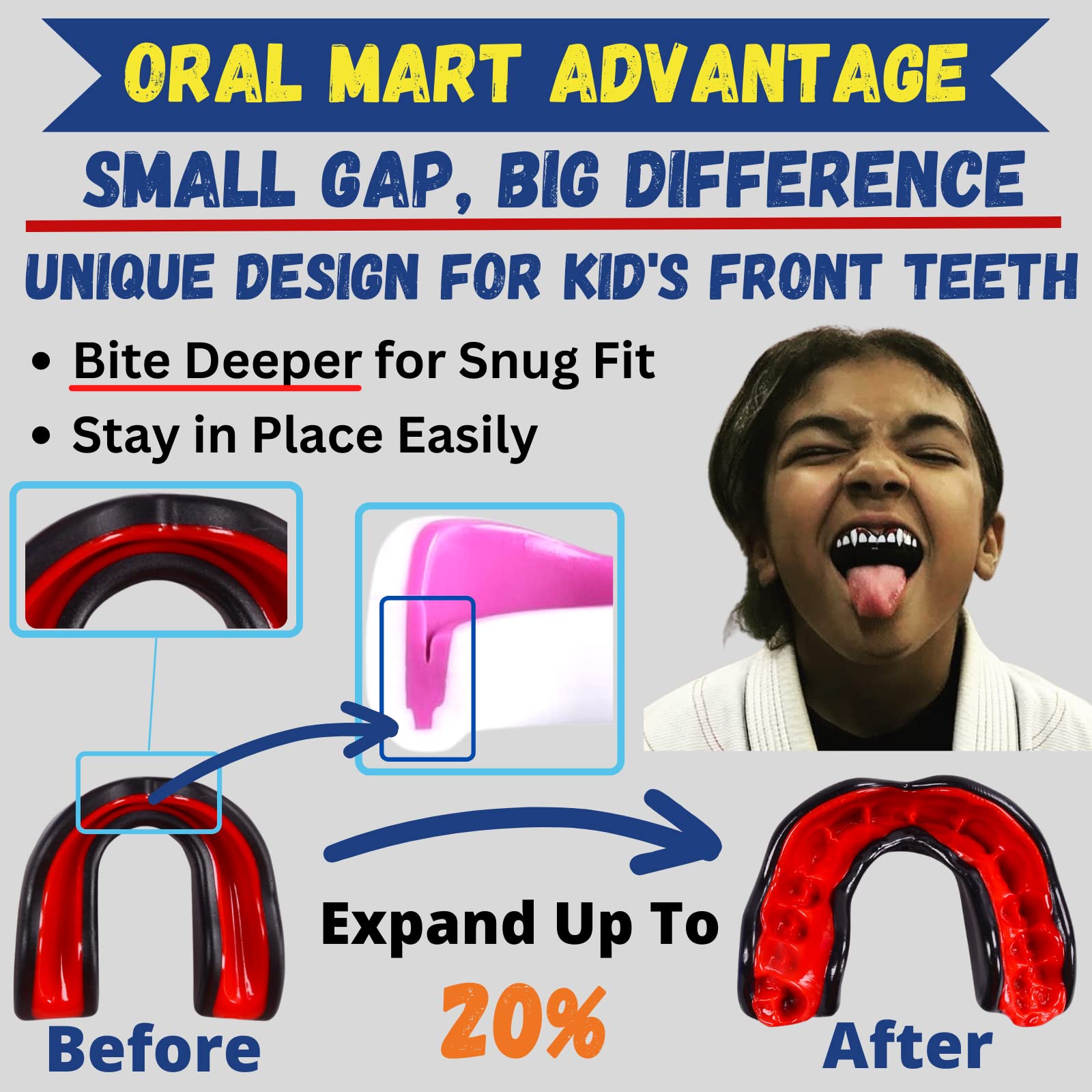 Oral Mart Sports Youth Mouth Guard for Kids (Be Water)
