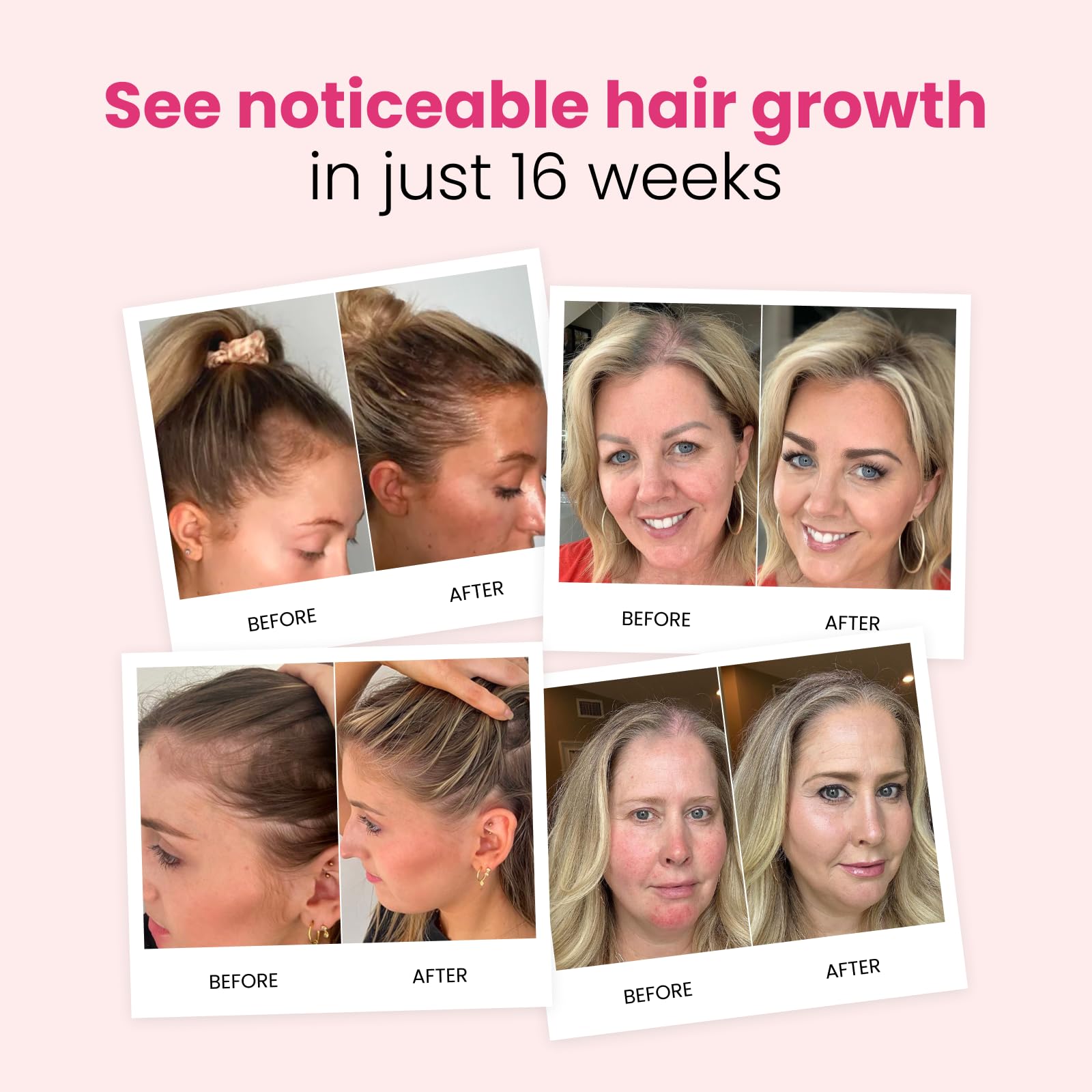 Trybello Hair Growth Shampoo with DHT Blocker | Natural Thickening & Scalp Detox | Sulfate Free & Vegan Formula | Caffeine, Aloe Vera, Turmeric, and Urucum Extract | For Any Hair Type