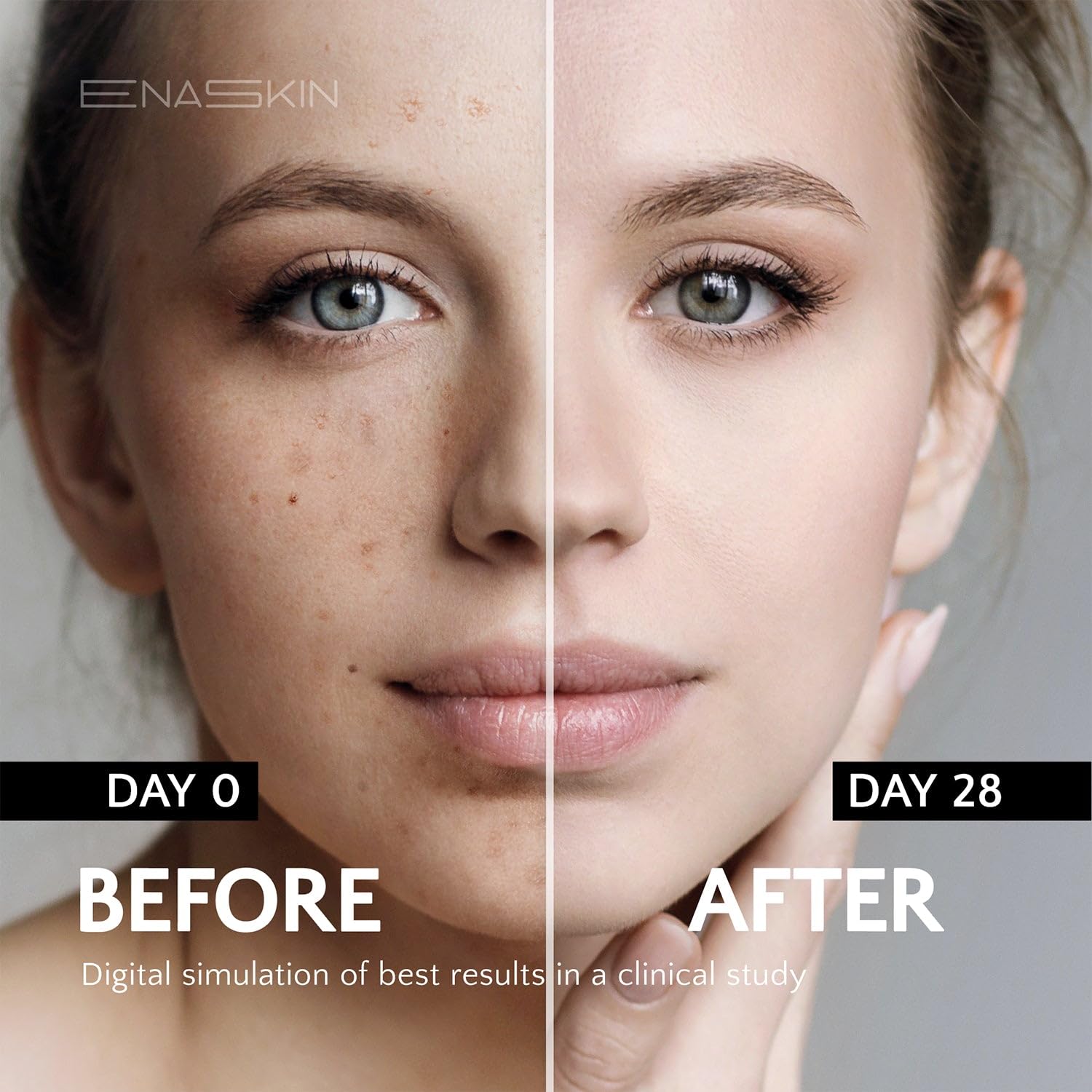 EnaSkin Dark Spot Remover for Face and Body: Age Spot Sun Spot Freckles Melasma Brown Spot Serum - Advanced Formula Corrector Cream with Niacinamide for Women and Men (1.0 Fl Oz)