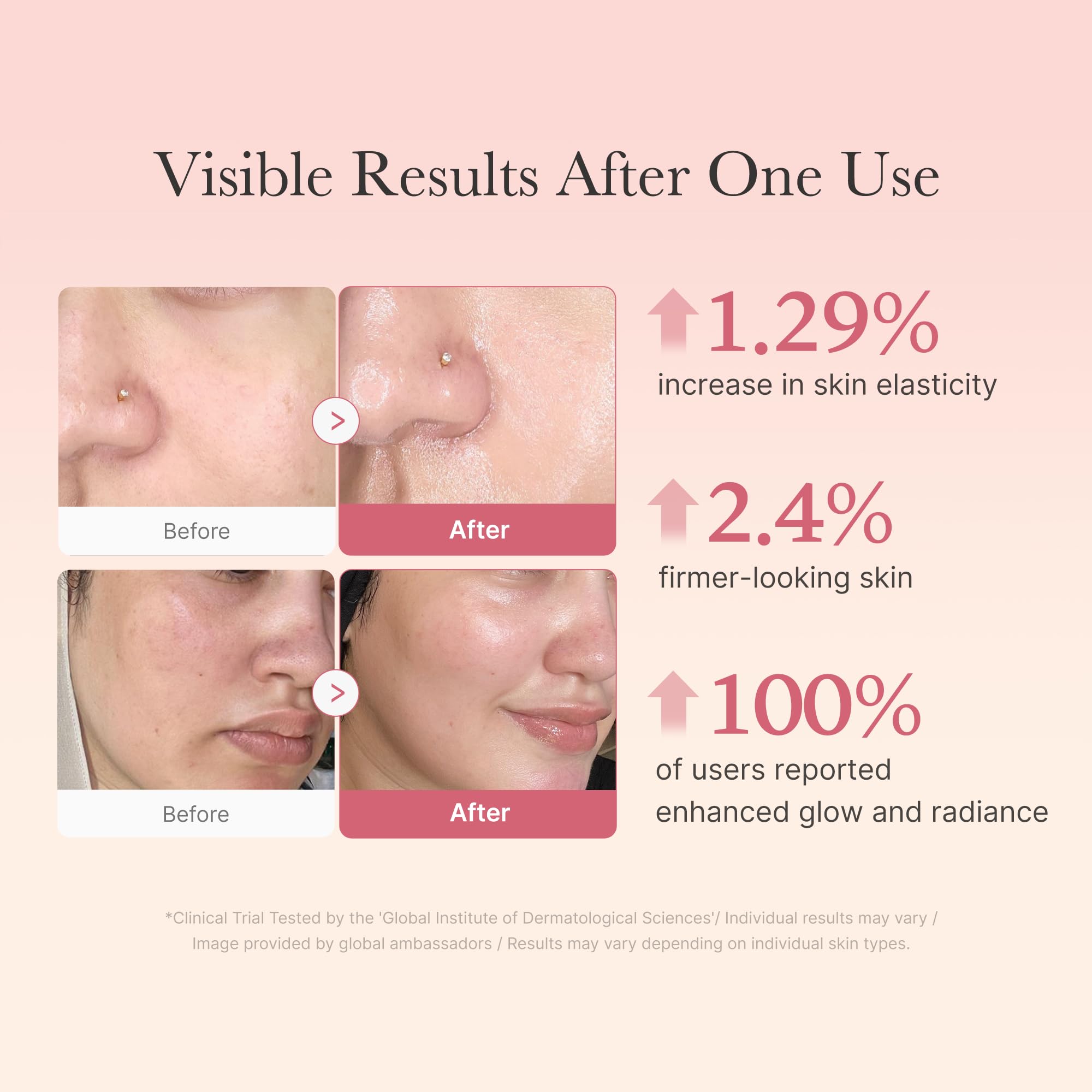 medicube Affordable Trio for Pore & Texture Care: Zero Pore Pads 2.0 and Zero Exosome Shot 7,500 PPM Spicule Facial Serum and Collagen Jelly Cream-50ml