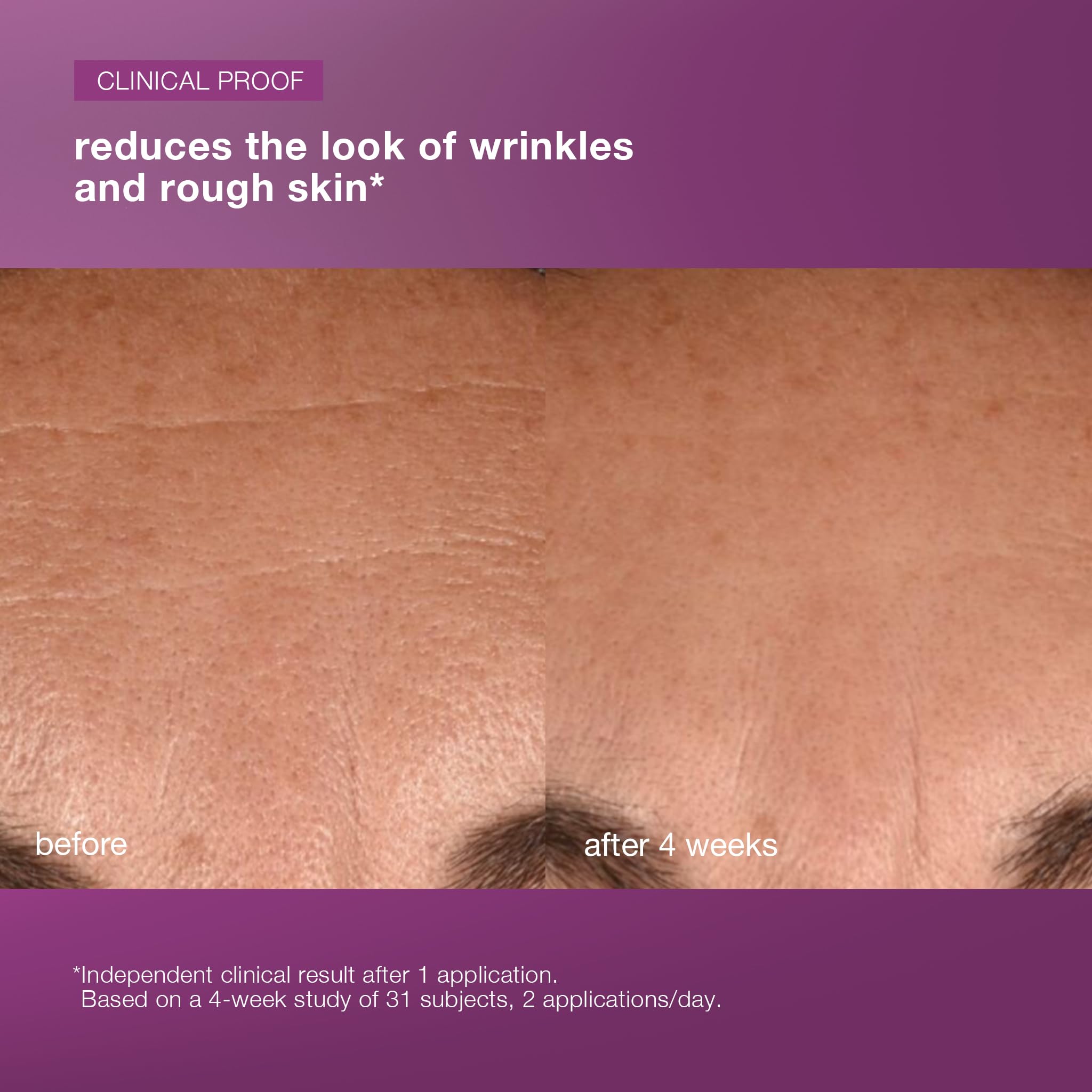 Dermalogica MultiVitamin Power Recovery Face Cream, Hydrating Facial Moisturizer with Antioxidants - Preventing Signs of Skin Aging, 1.7 fl oz