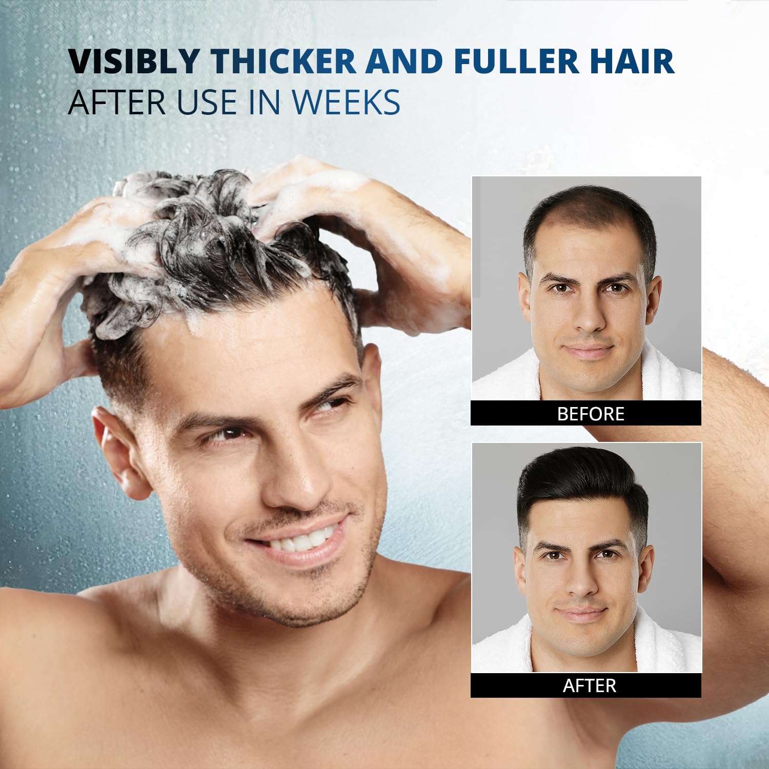 Root Activator Shampoo for Men: Hair Growth Shampoo for Hair Loss and Thinning Hair - Hair Loss Regrowth Shampoo for Men Women (Refreshing Scent)