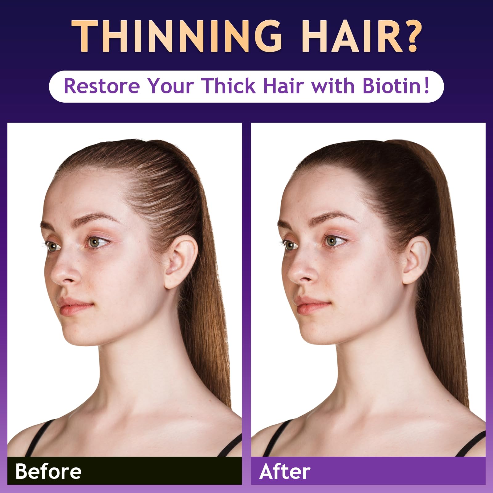 Biotin Hair Growth & Thickening Shampoo with Root Activator, Hair Loss Shampoo for Men And Women, Strengthen Roots, Control Oil & Thicken Thin Hair, Sulfate-Free, for All Hair Types, 10.1 Fl Oz-Fresh