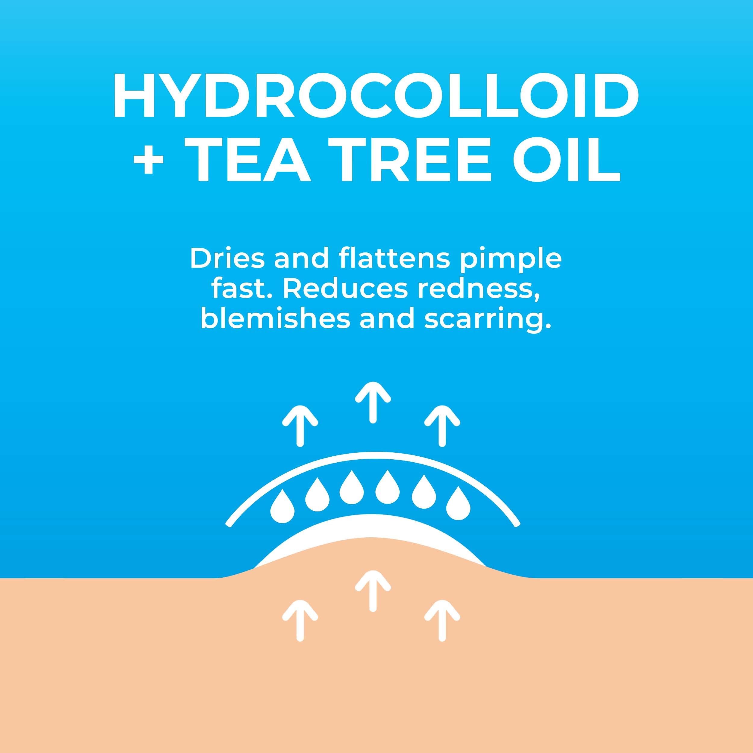 PatchRx Pimple Patches for Face (120 Patches), Hydrocolloid Acne Patches with Tea Tree Oil, Pimple Patch Pimple Stickers - Hydrocolloid Patch Acne Dots - Acne Pimple Patches For Face - Zit Patches