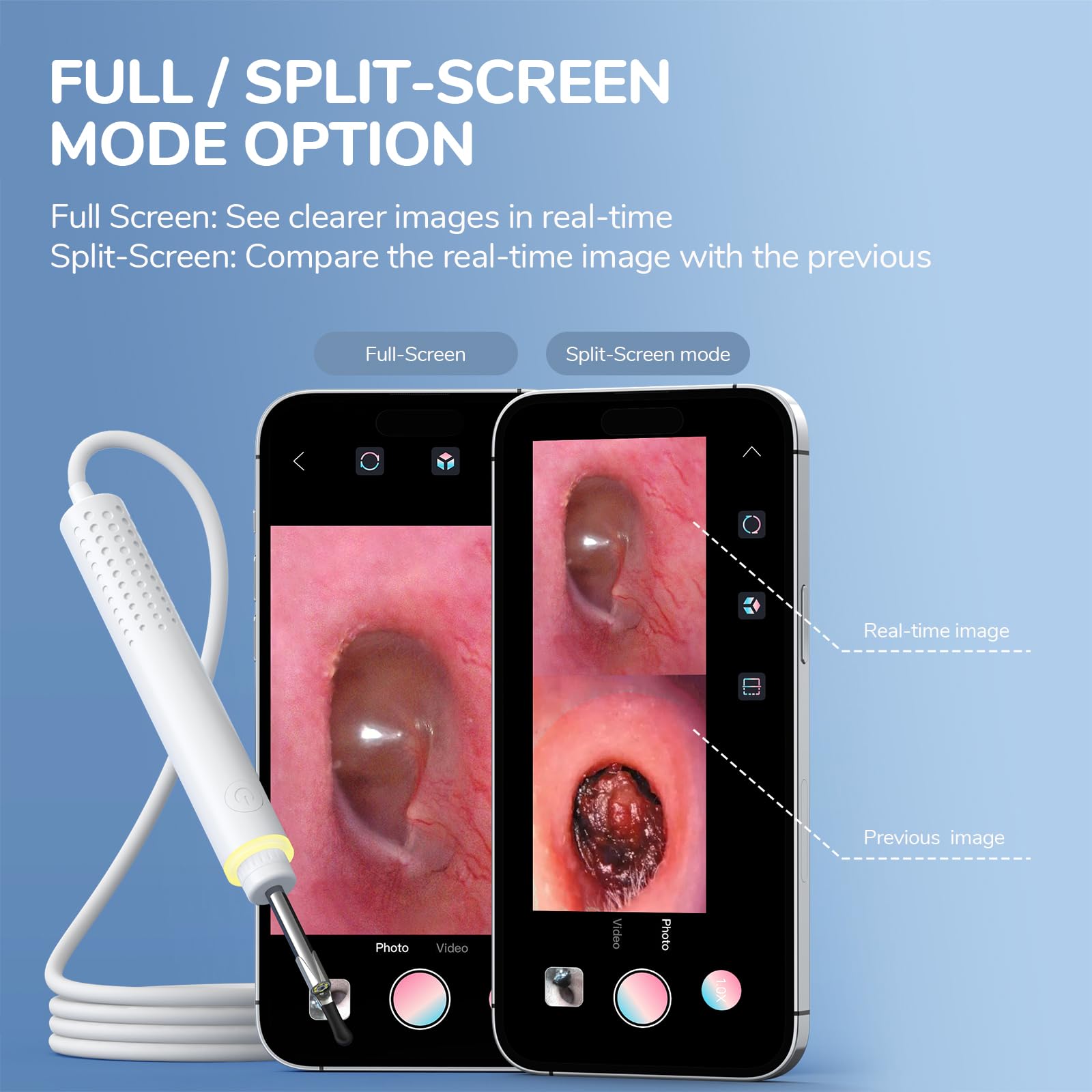 Otoscope Compatible with iPhone 15/Android, ScopeAround 3.9mm Ultra-Thin Ear Camera with 6 LED Lights, Digital Otoscope with Ear Wax Removal Tool, USB Plug & Play Ear Wax Camera for Android
