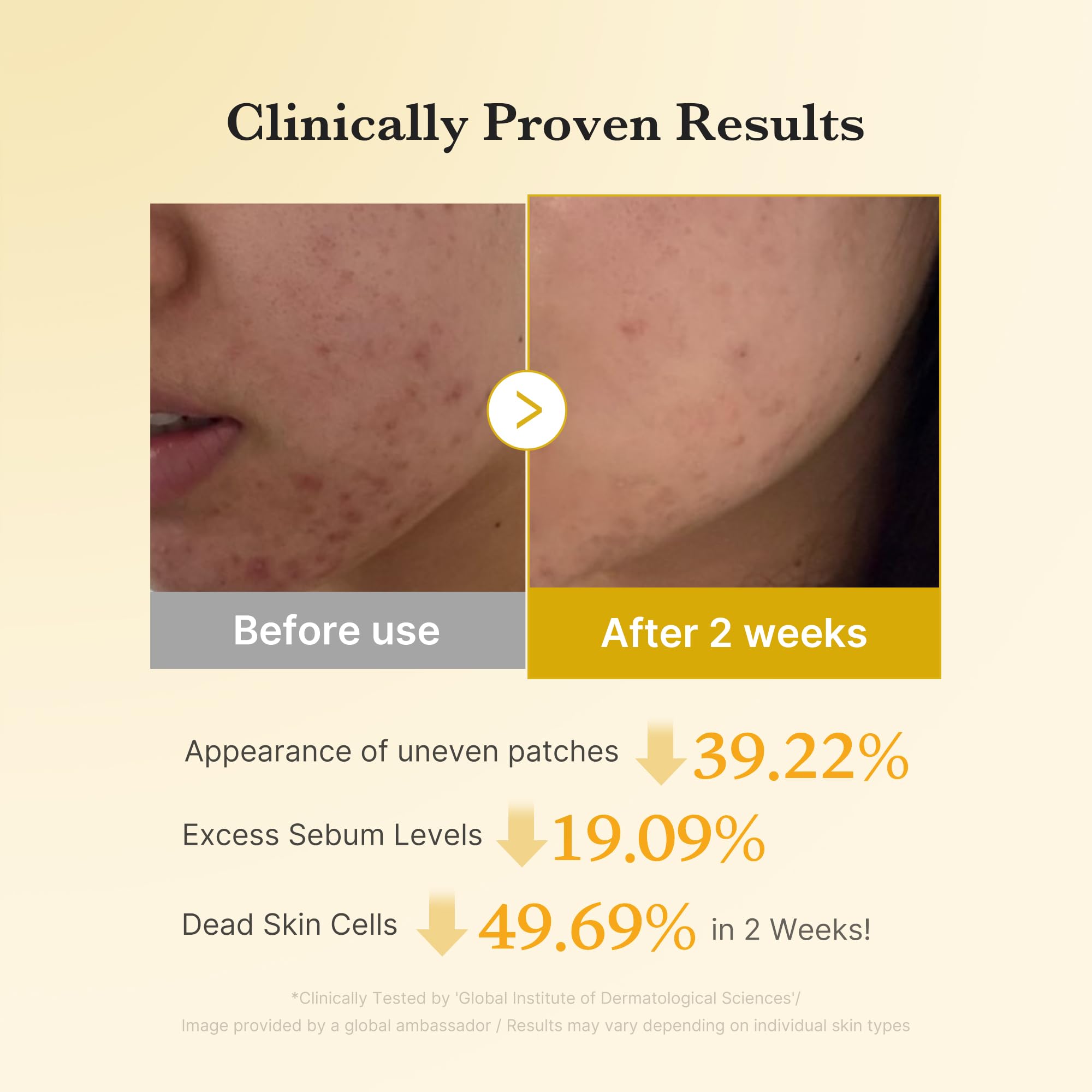 medicube Kojic Acid Prep and Seal Duo for Troubled Skin: Kojic Acid Turmeric Overnight Wrapping Peel Off Mask and Kojic Acid Turmeric Clarifying Toner Pad