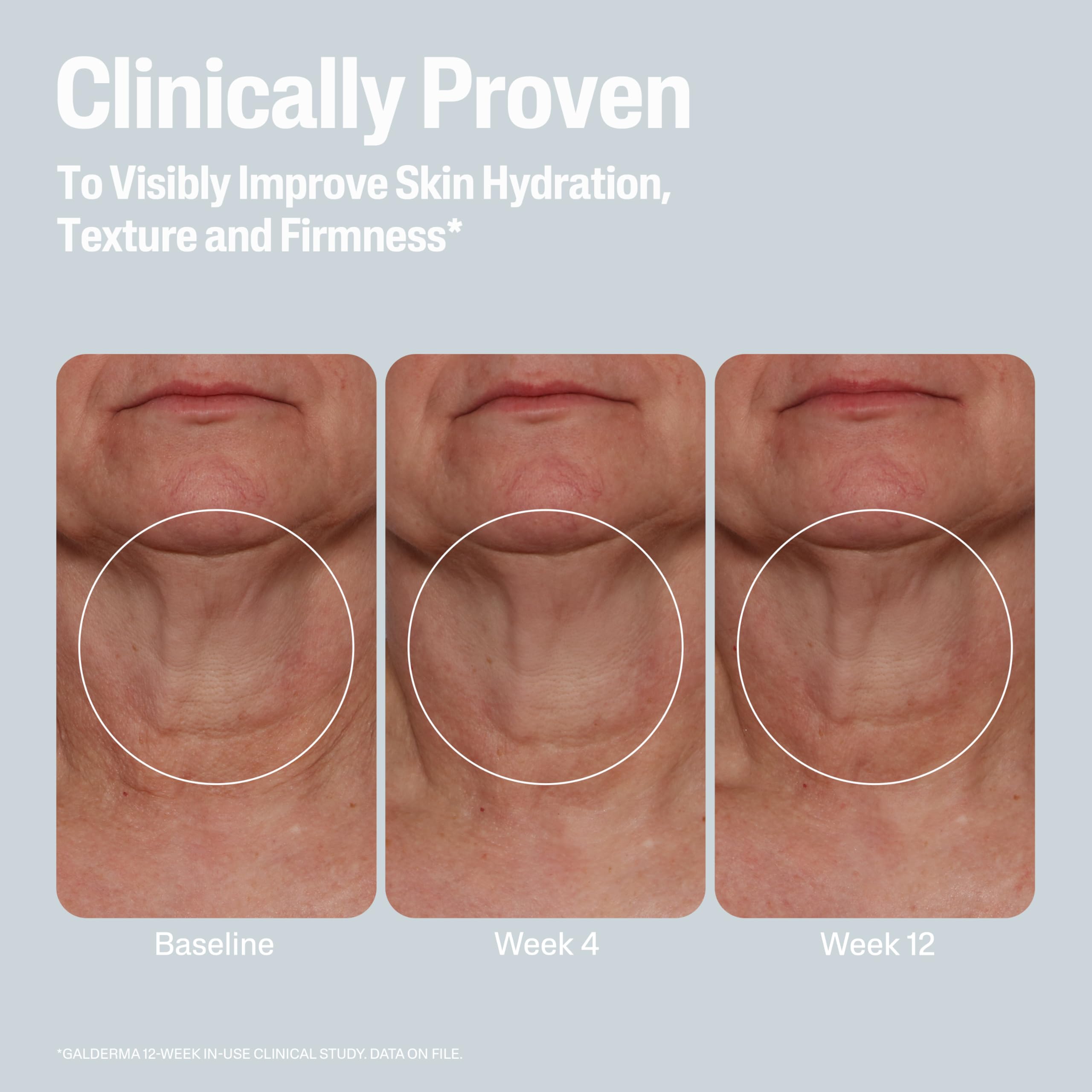 Cetaphil Skin Activator Hydrating & Firming Body Cream 12oz, Mandelic Acid (AHA) and Centella Asiatica (CICA) Cream, Hydrates and Firms Aging Skin, Anti-Aging Skincare, 12 oz