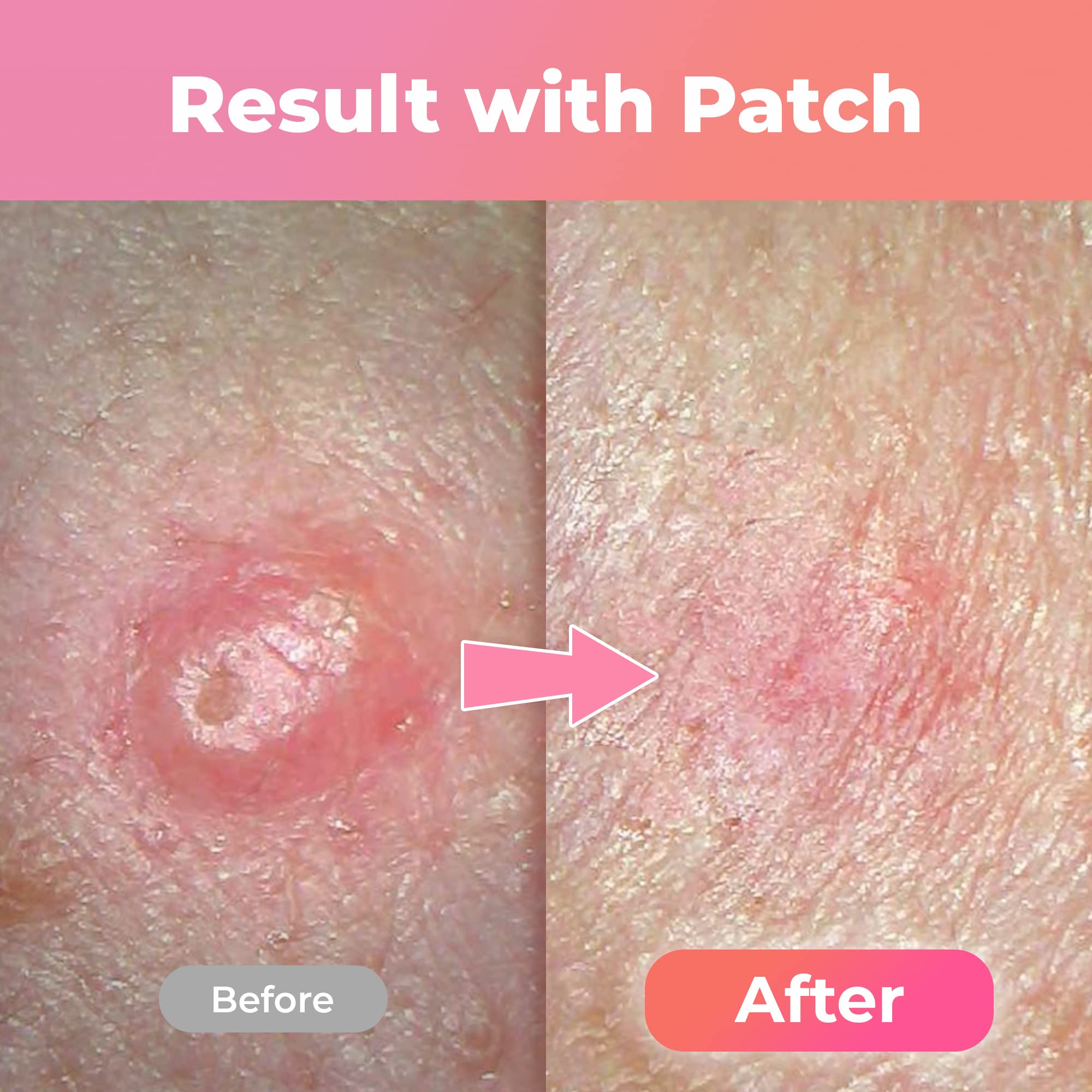 Dr.Eviss Amazing Patch Overnight Spot Cover 104ea
