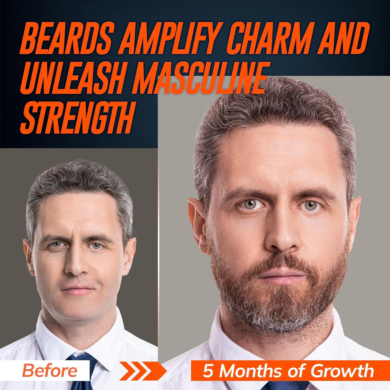 Hair & Beard Growth Serum 2-Pack Kit – Biotin & Rice Water Extra Strength Formula for Thinning Hair, Receding Hairlines & Patchy Beards – Long-Lasting Growth Solution for Men & Women