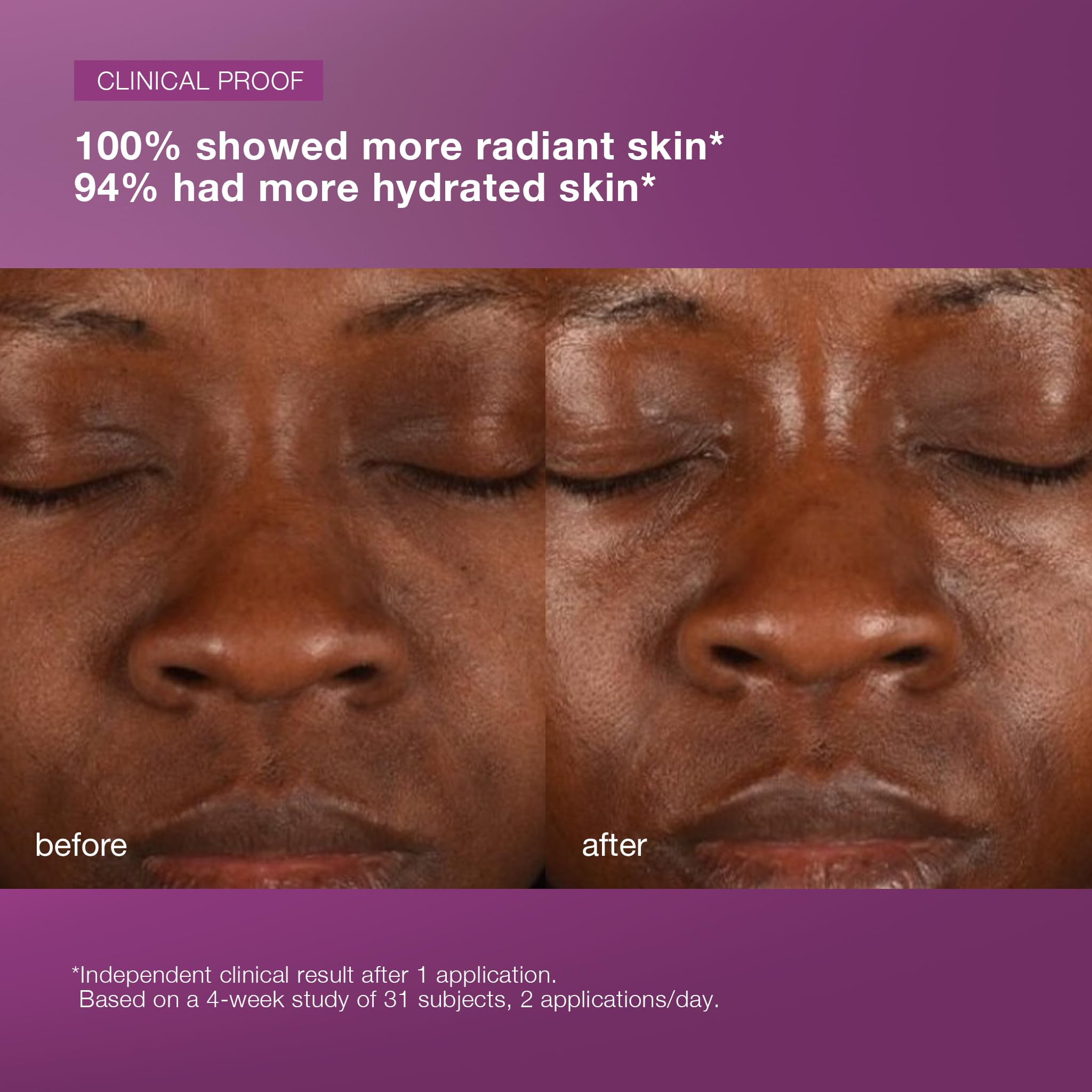 Dermalogica MultiVitamin Power Recovery Face Cream, Hydrating Facial Moisturizer with Antioxidants - Preventing Signs of Skin Aging, 1.7 fl oz